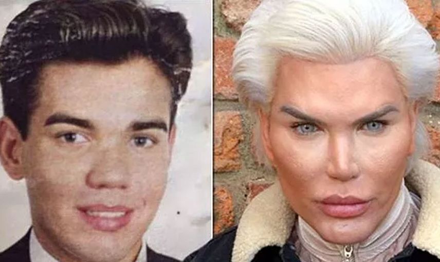Barbie'nin sevgilisi Ken bebeğe benzemek için ameliyat olan Rodrigo Alves
