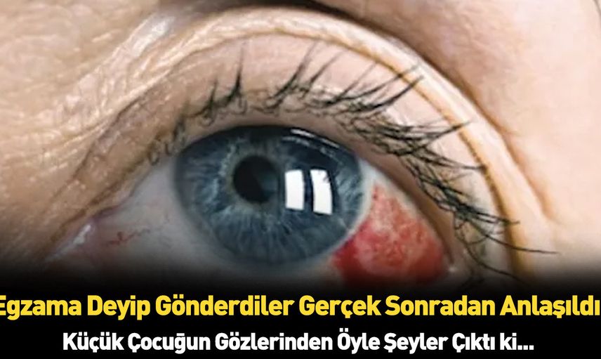 Egzama dediler kasık biti çıktı: Küçük çocuğın başına gelmeyen kalmadı!