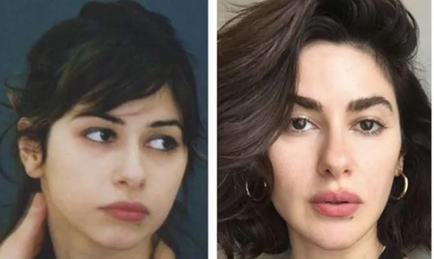 Eski Halini Görünce Şok Olacağınız 15 Ünlü 