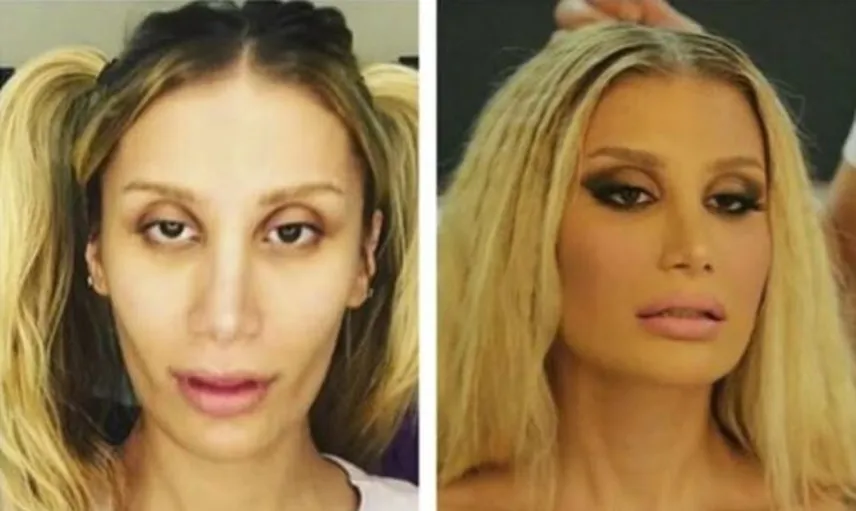 Eski Halini Görünce Şok Olacağınız 15 Ünlü 