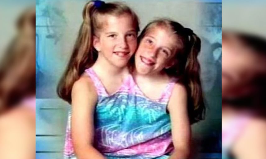 Yaşama şansları yok deniyordu! Yapışık ikizler Abby ve Brittany Hensel ABD'li bir savaş gazisiyle evlendi!