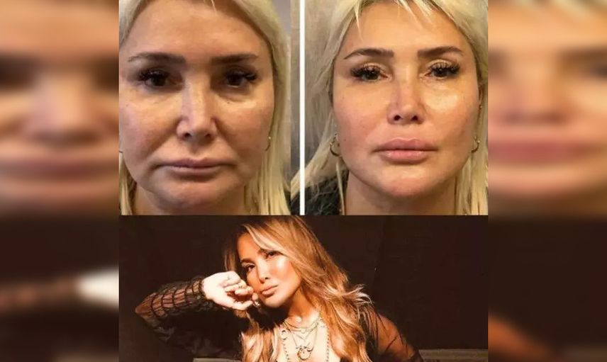 60 yaşındaki Yonca Evcimik estetik yaptırdı! Bambaşka birine döndü: Son hali alay konusu oldu...