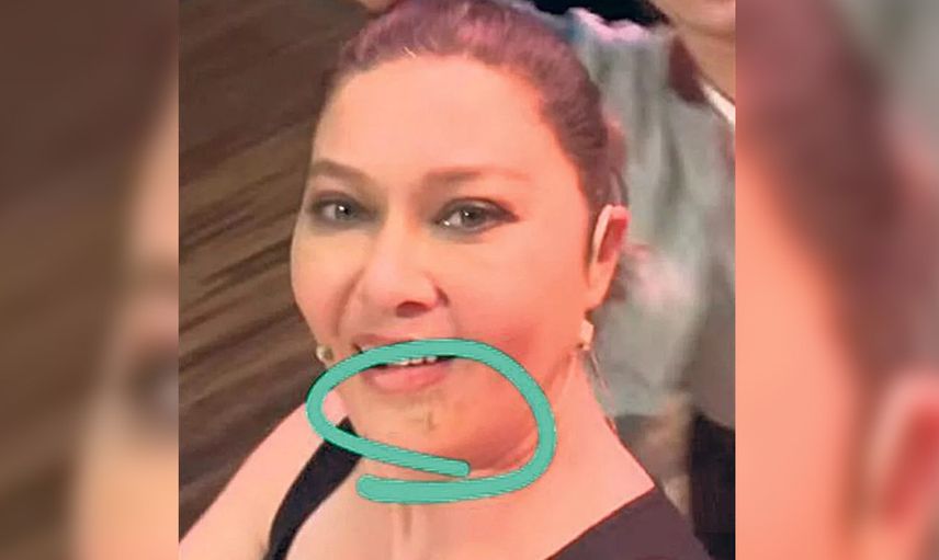 Nurgül Yeşilçay'ın kazadan sonraki hali yürek dağlıyor