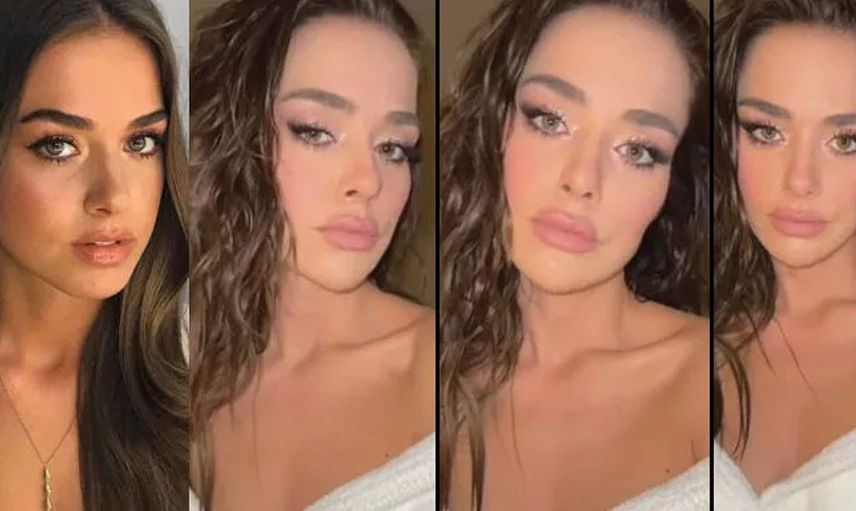 Bensu Soral estetik kurbanı oldu: Gören tanıyamıyor