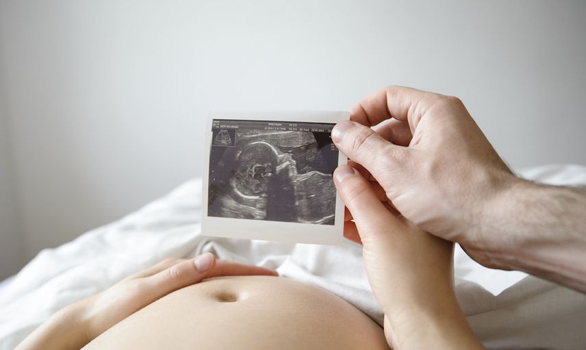 ABD'de hamile olan kadının ultrason görüntüsünü gören doktora gördüklerine inanamadı