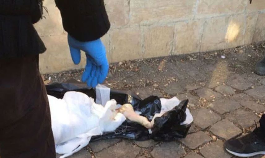 Bugüne kadar gizemi çözülmemiş Türkiye'nin en korkunç seri cinayet vakası 'kesik bacaklar'!