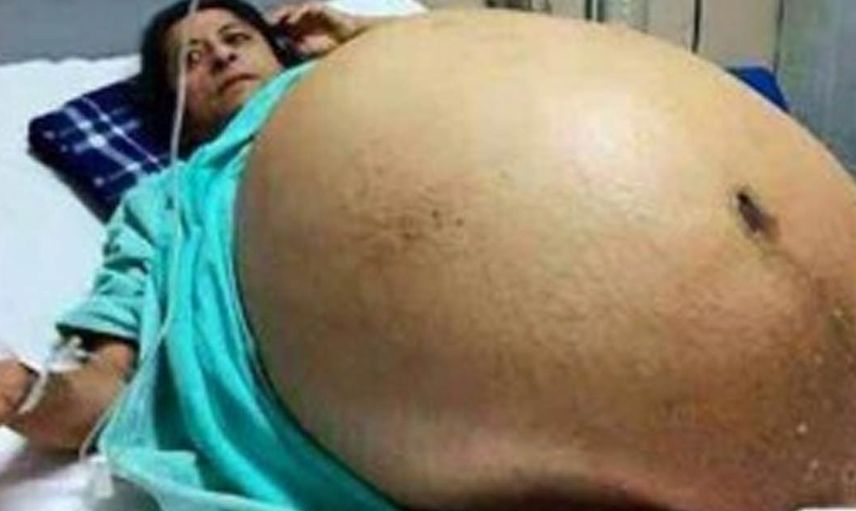 11 çocuk doğurmuş gibi