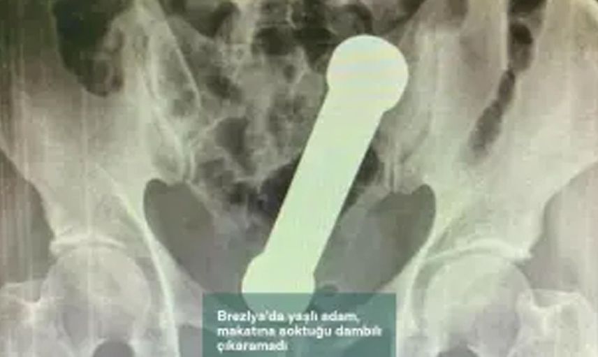 Ameliyata alındı