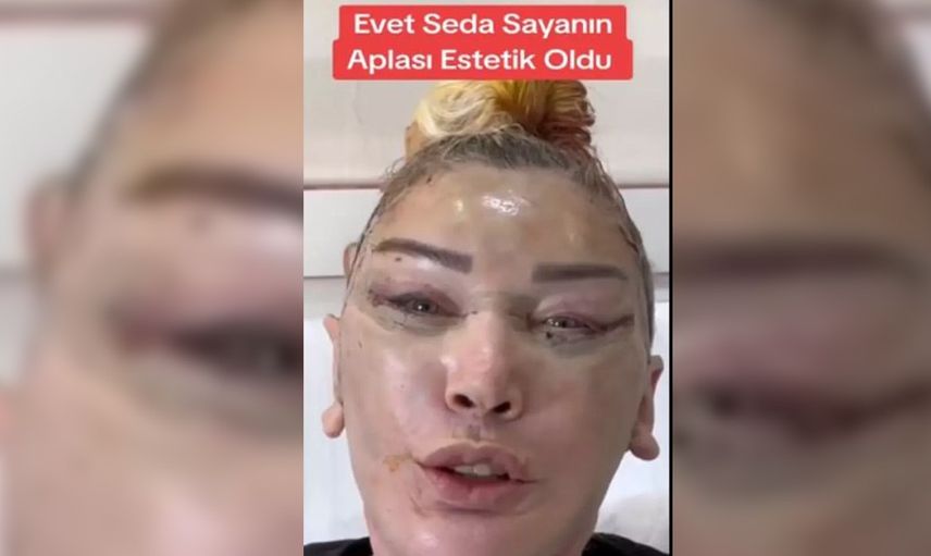 Seda Sayan bu kez de ablasına estetik yaptırdı! Son halini görenler dondu kaldı...