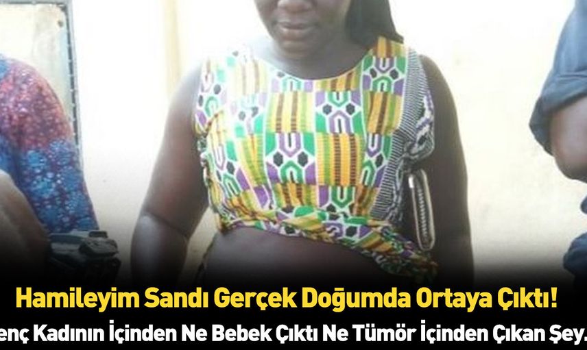 Güney Afrika'da eşi benzeri olmayan doğum olayı