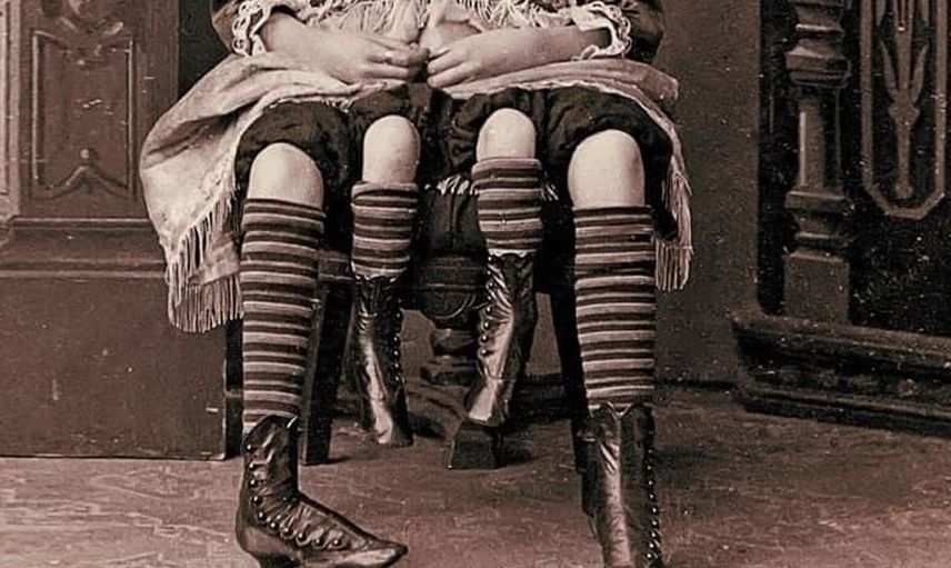 Dört bacak ve iki rahimle doğan kadın Myrtle Corbin'nin hayat hikayesi