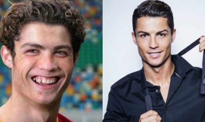 Ronaldo