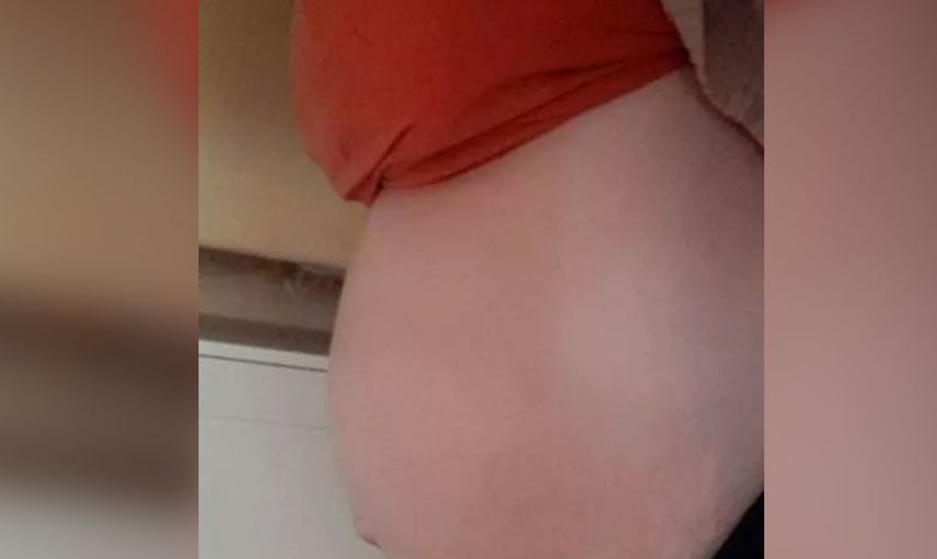 Kilo aldın diye azarlayıp geri gönderdiler! Zavallı kadının karnından çıkan şeyler doktorları bile utandırdı