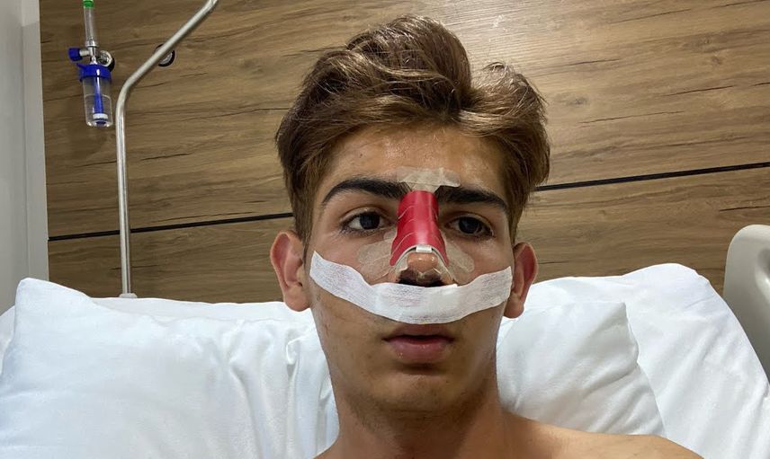 Estetik operasyonları geçirdi
