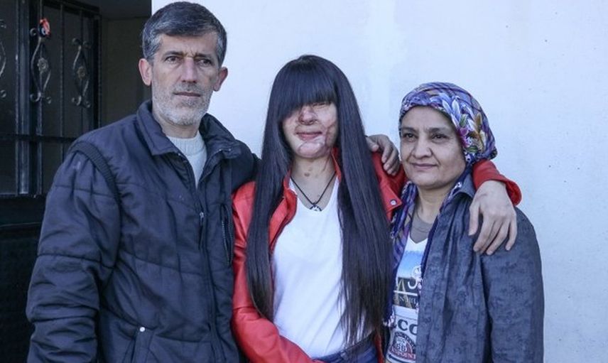Yüzünü Yakan Kişiyle Evlenen Berfin Özek’in Babası Konuştu