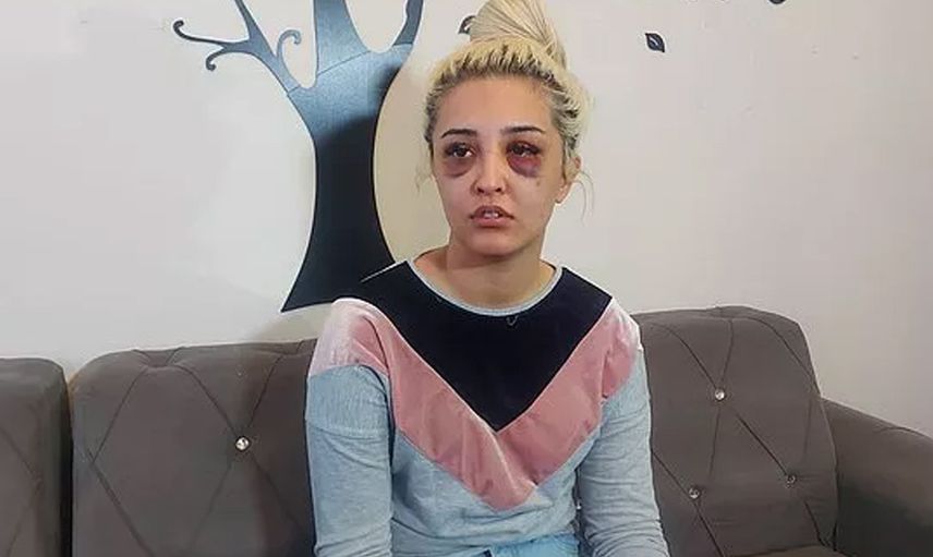 İzmir’de korkunç olay! Gamze Tümtürk’ün sevgilisi önce dövdü sonra uyumak istedi