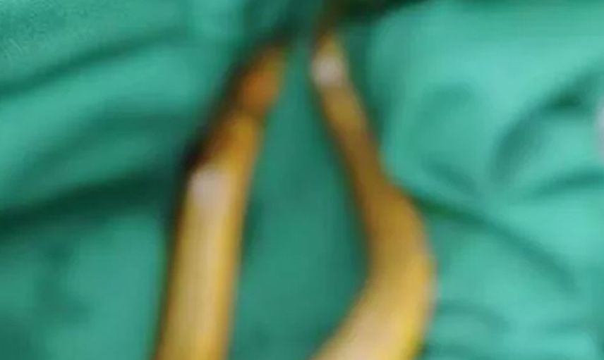 Türlü sex oyuncakları yüzünden sonu hastanelik olan insanlar