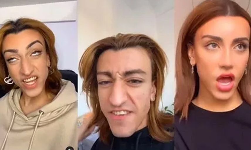 Estetik operasyonları geçirdi