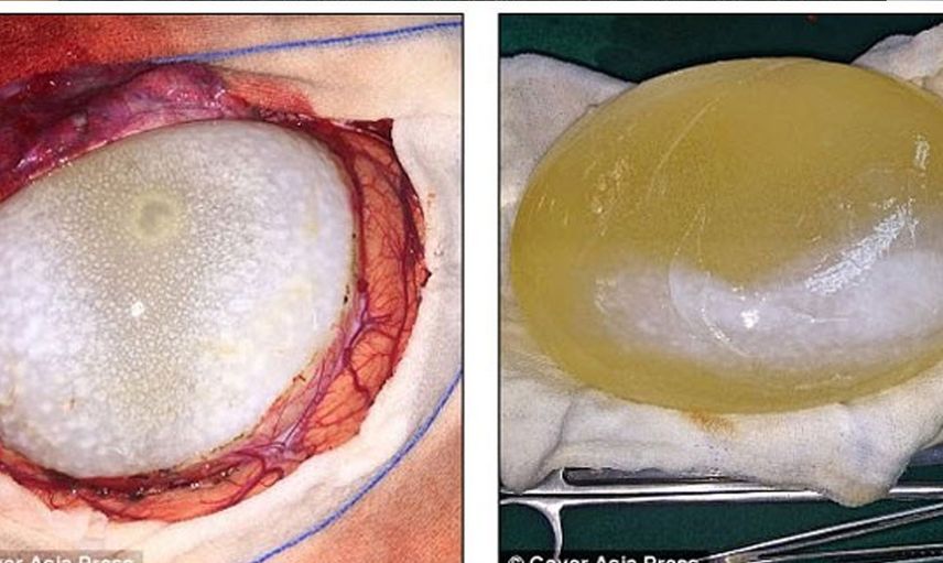 Felçli kızı muayene eden doktor sebebini anlayınca hayret etti