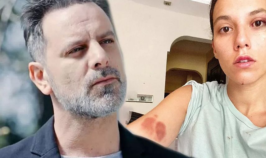 Ozan Güven'in eski sevgilisi Deniz Bulutsuz'u darp ettiği davada son gelişme: Adli Tıp Kurumu raporu hazırladı