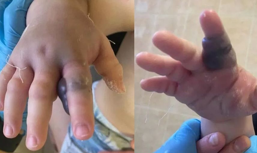 Küçük bebek engerek yılanının kurbanı oldu! Annesi fark edene kadar zehir yayıldı bebeğin son halini görenler inanamadı