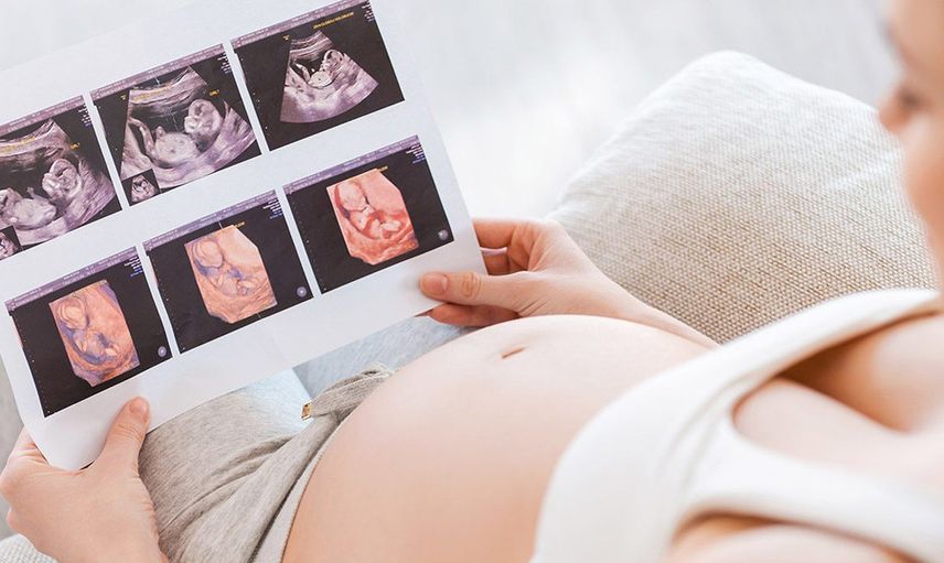 ABD'de hamile olan kadının ultrason görüntüsünü gören doktora gördüklerine inanamadı