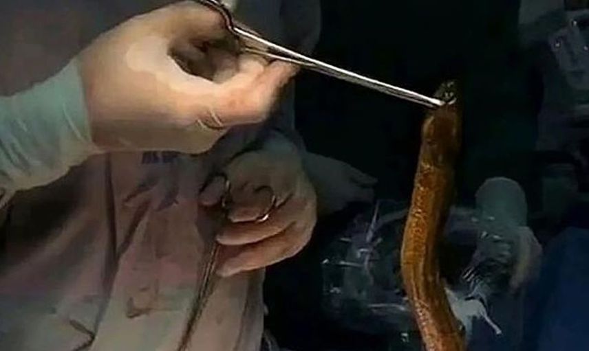 Bu nasıl tedavi yöntemi! Kabız olan adam çareyi yılan balığında buldu ama yemek yerine çok daha fenasını yaptı