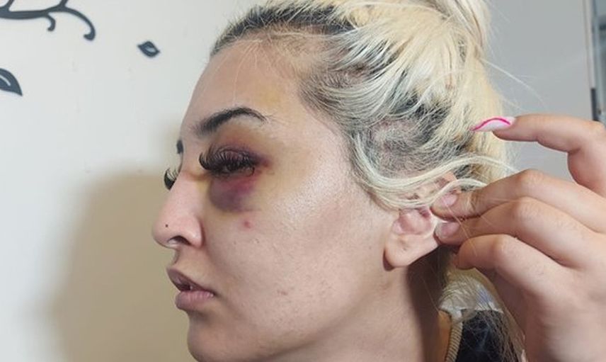 İzmir’de korkunç olay! Gamze Tümtürk’ün sevgilisi önce dövdü sonra uyumak istedi
