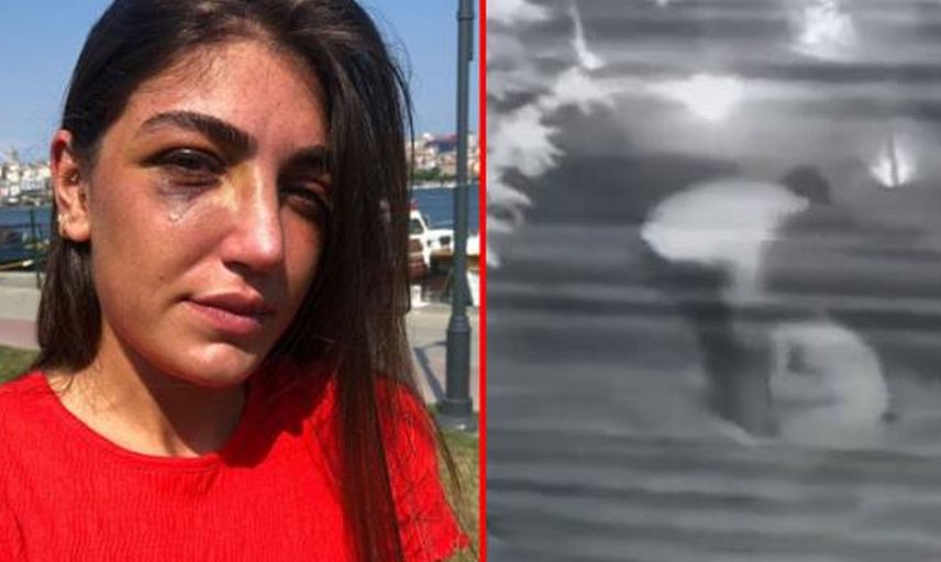 Manken Gizem Akbaş Eski Sevgilisi Tarafından Darp Edildi