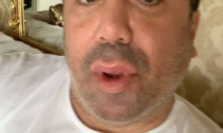 Murat Övüç İlk Eşiyle Neden Evlendiğini Açıkladı!