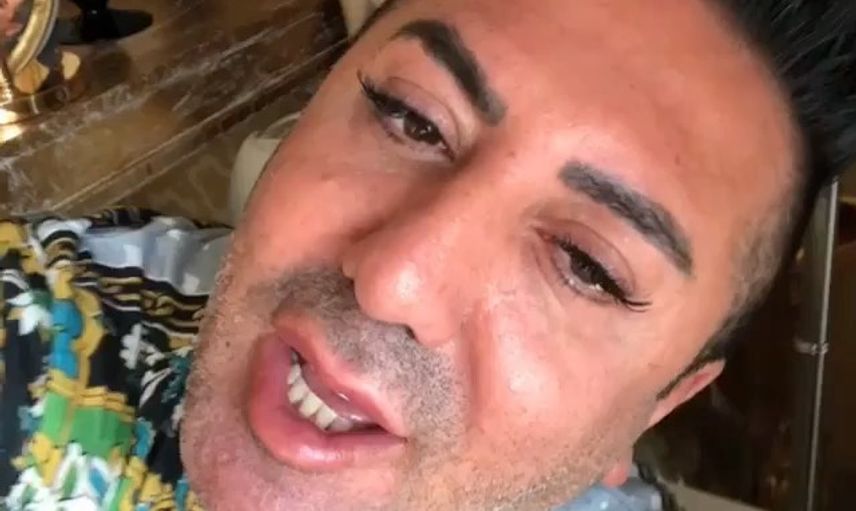 Murat Övüç İlk Eşiyle Neden Evlendiğini Açıkladı!