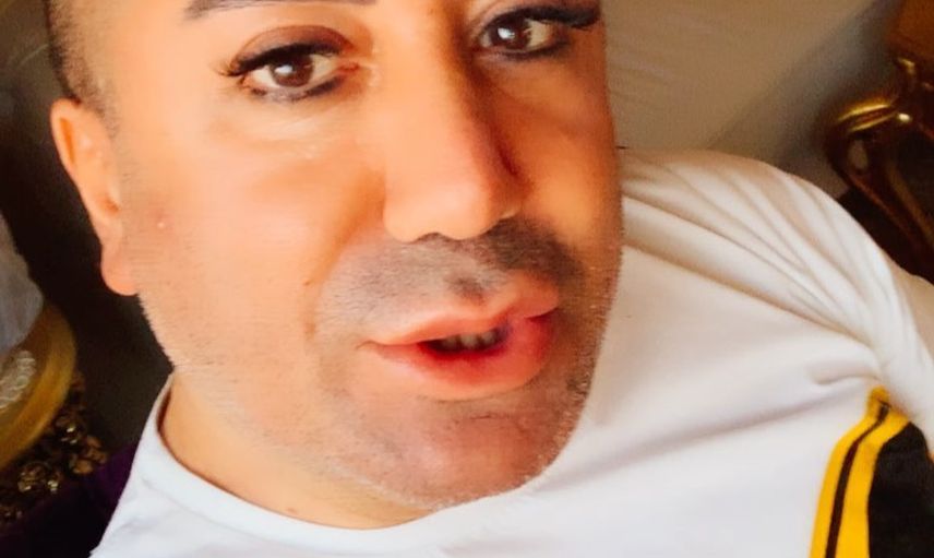 Murat Övüç İlk Eşiyle Neden Evlendiğini Açıkladı!