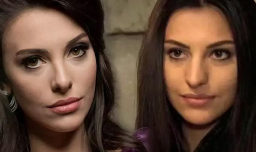 Tuvana Türkay köpeğini kurtarmak isterken ölümden dönüyordu