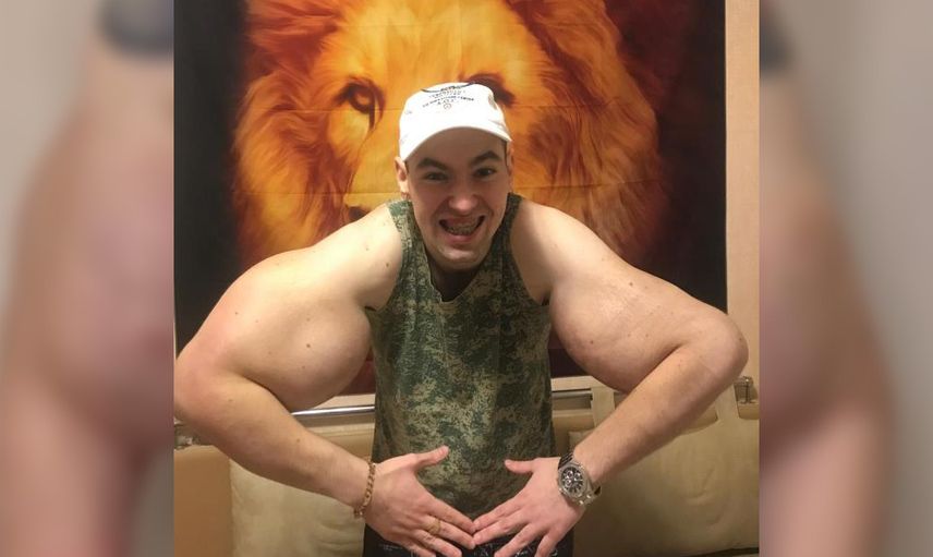 Kirill Tereshin kimdir, kol kasları gerçek mi? Sosyal medya fenomeni Temel Reis’e benzemek için servet harcadı! Kollarını gören şaşırıyor