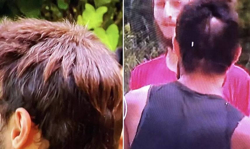 Survivor Batuhan rezil oldu! Saçlarıyla ilgili detay ifşa edildi: Peruk mu takıyor?
