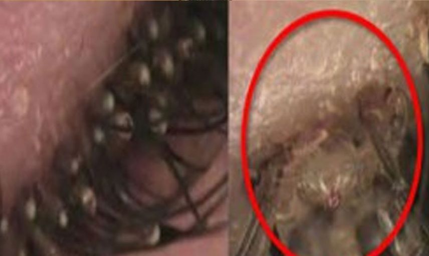 Egzama dediler kasık biti çıktı: Küçük çocuğın başına gelmeyen kalmadı!