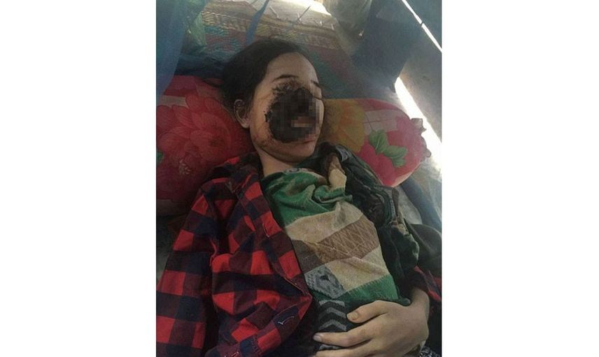 Böylesini ilk defa göreceksiniz! Dişini çektirmeye gitti yüzünü kaybetti