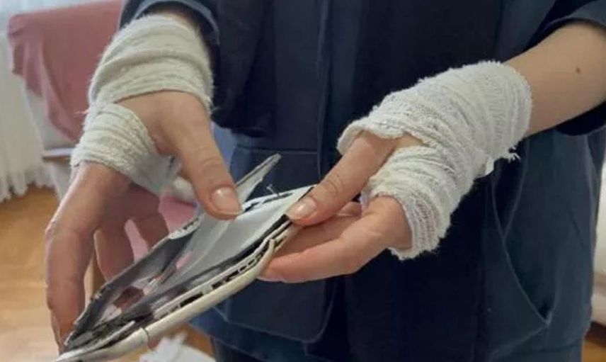 Sakarya'da dayak yiyen kadın kabusu yaşadı