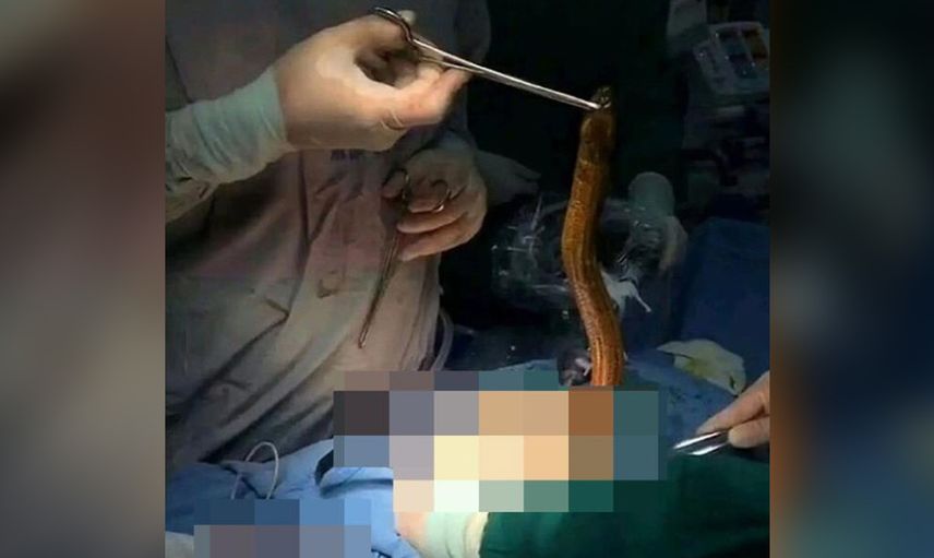 Bu nasıl tedavi yöntemi! Kabız olan adam çareyi yılan balığında buldu ama yemek yerine çok daha fenasını yaptı