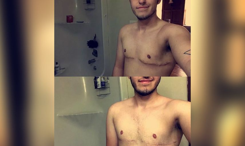 Bir türlü karar veremedi: 19 yaşındaki genç iki kez cinsiyet değiştirdi!