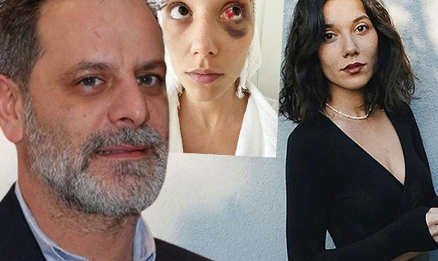 Ozan Güven'in eski sevgilisi Deniz Bulutsuz'u darp ettiği davada son gelişme: Adli Tıp Kurumu raporu hazırladı