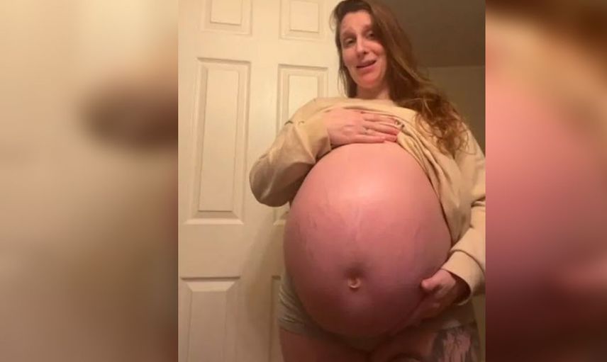 Basına hamilelik pozları verilmişti, meğer hamile değilmiş! Doktorlar bile şaşırdı, bebek sandıkları şey aslında...