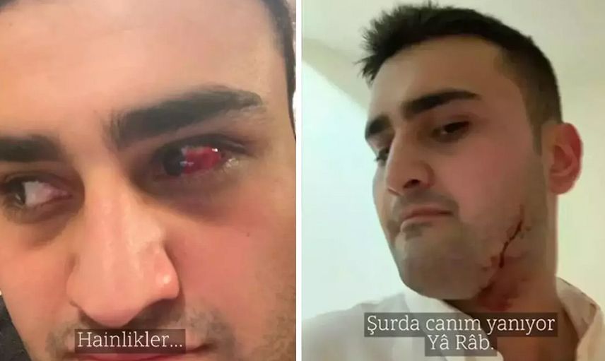 Açıklama geldi!