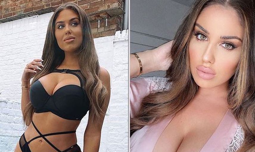 Love Island’ın Anna Vakili’si popo ameliyatı için Türkiye’ye geldi: “Cinayet mahalli gibiydi, öleceğimi sandım”