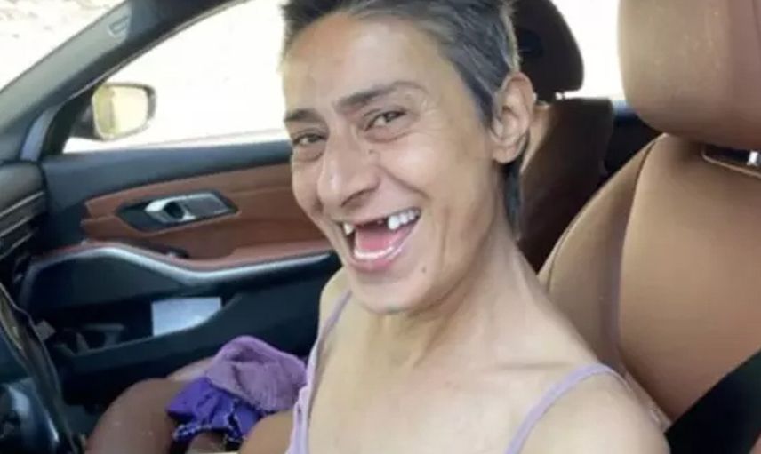 Yıldız Tilbe'den şoke eden poz: Dişsiz halini paylaştı, hayranlarını korkuttu!