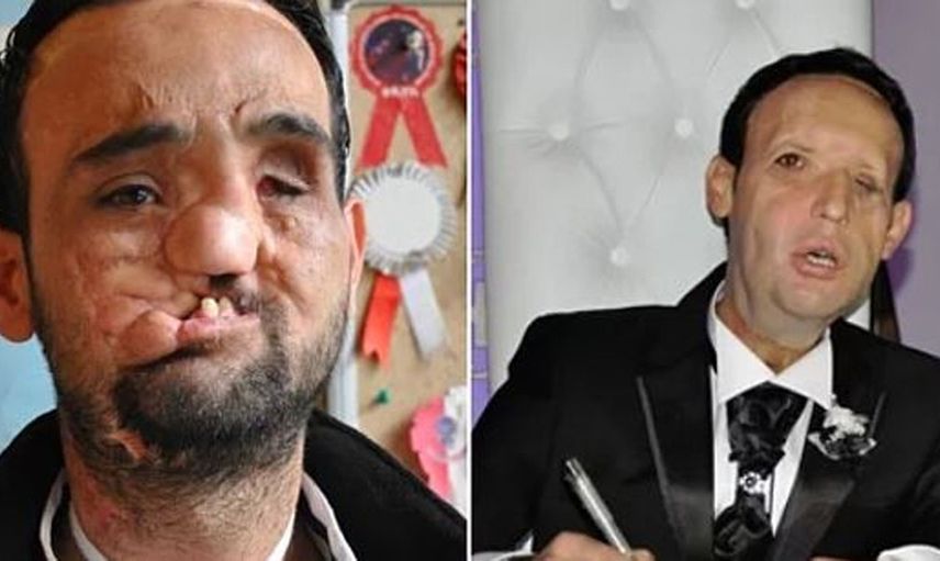 Recep Sert