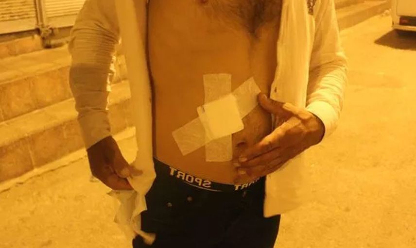 Gaziantep'te Evinin Damında Çay İçen Adam Saçmaların Hedefi Oldu