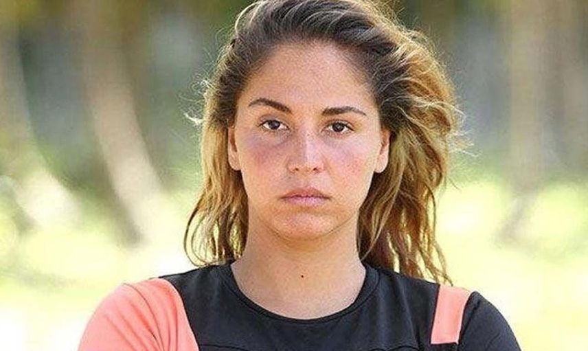 Survivor Berna Keklikler kimdir? Survivor All Star Berna elendi mi, yarışmaya veda mı ediyor? Survivor’da bu hafta adaya veda eden isim belli oldu
