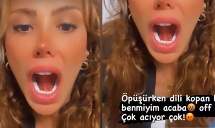 Ceyda Ersoy'un öpüşürken dili koptu