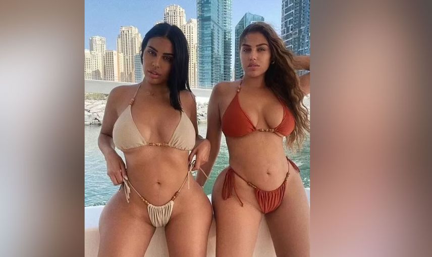 Love Island’ın Anna Vakili’si popo ameliyatı için Türkiye’ye geldi: “Cinayet mahalli gibiydi, öleceğimi sandım”